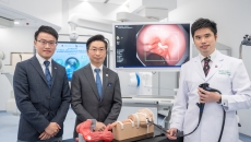 CU Medicine research team with the new Olympus endoscopy AI system CU Medicine research team with the new Olympus endoscopy AI system