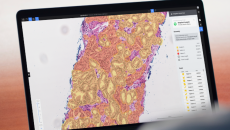 Deep Bio's prostate cancer analysis AI Deep Bio's prostate cancer analysis AI