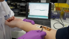 A hydrogel-based sensor detects solid-state biomarkers on the skin A hydrogel-based sensor detects solid-state biomarkers on the skin