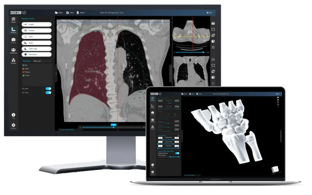 Singular Health's 3Dicom MD software