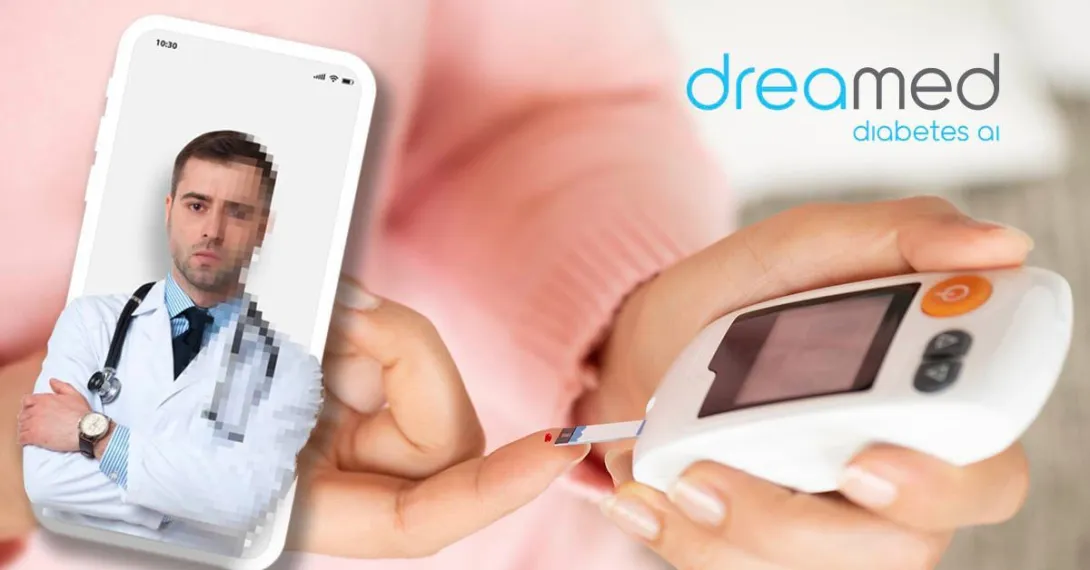 The DreaMed diabetes device