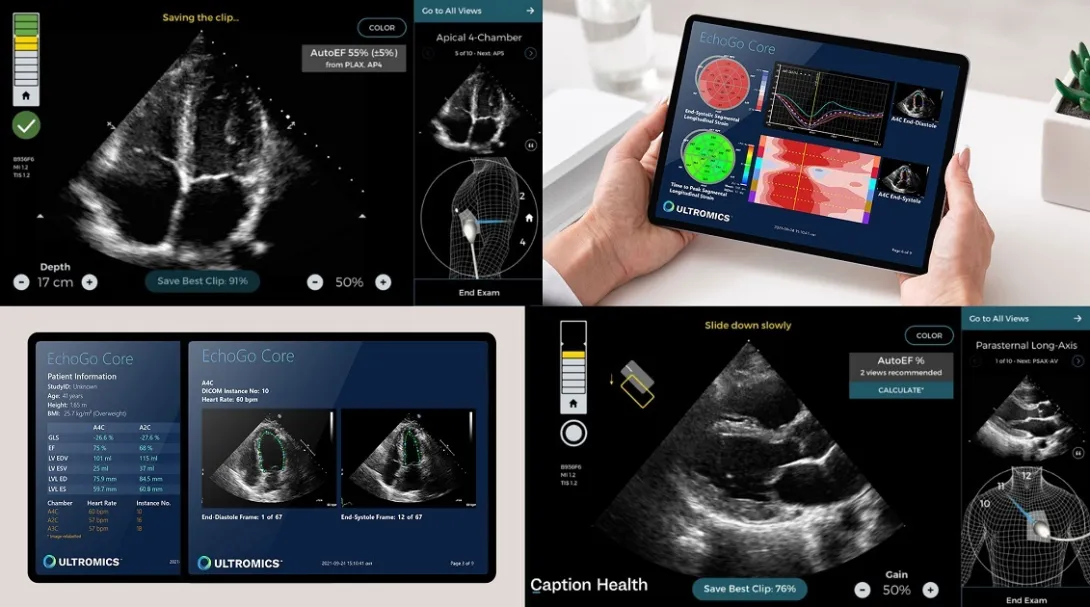 Ultromics, ultrasound, AI, dianostics, Caption Health