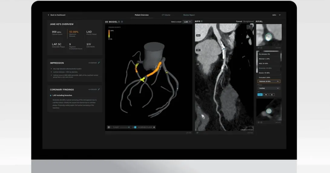 Artrya Salix AI decision support tool for diagnosing coronary heart disease