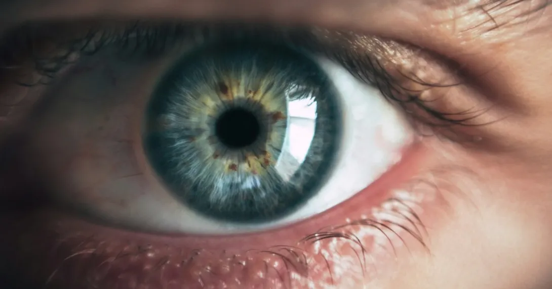 Photo of an eye